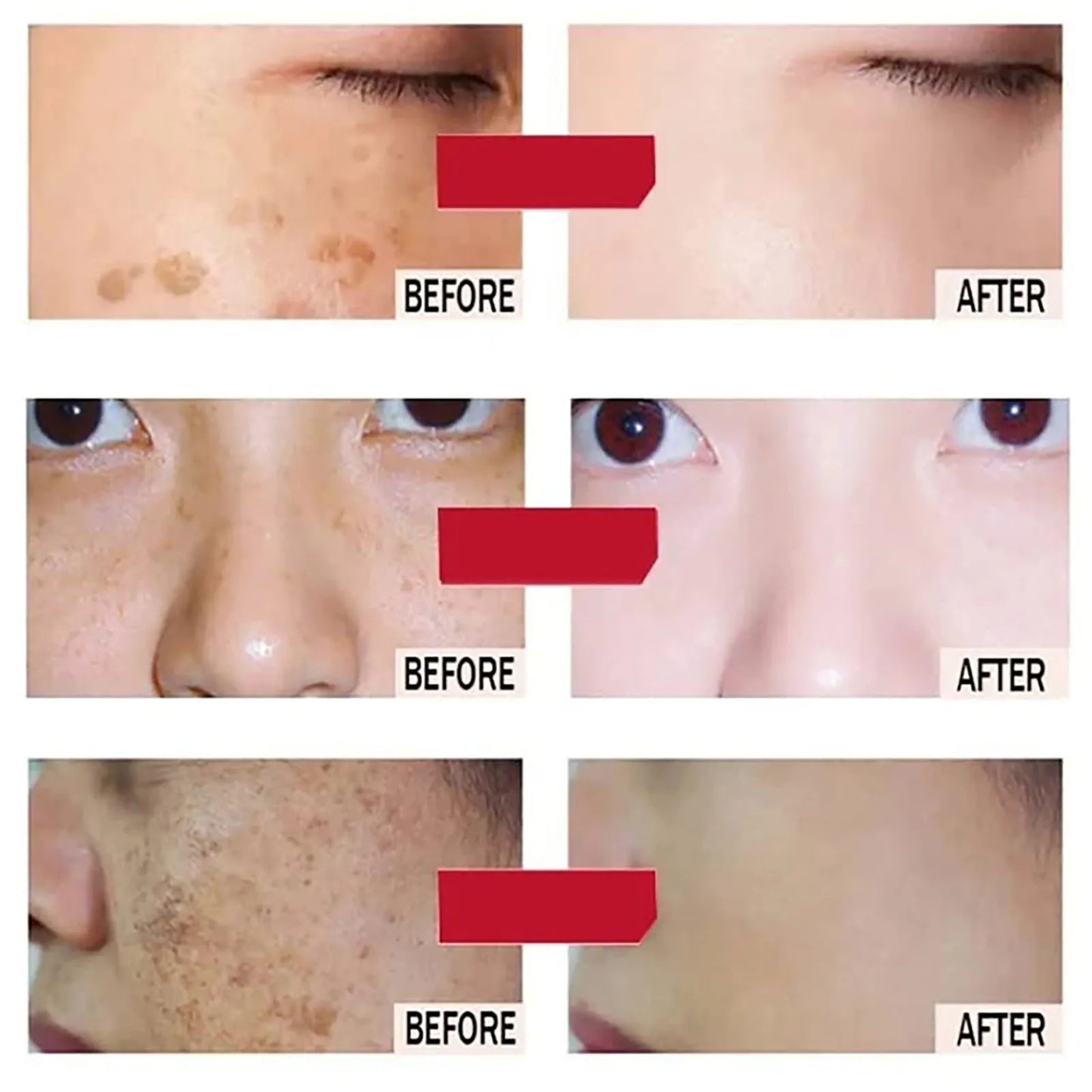 AILKE 24k Gold Face Cream Whitening Dark Spots Glutathione