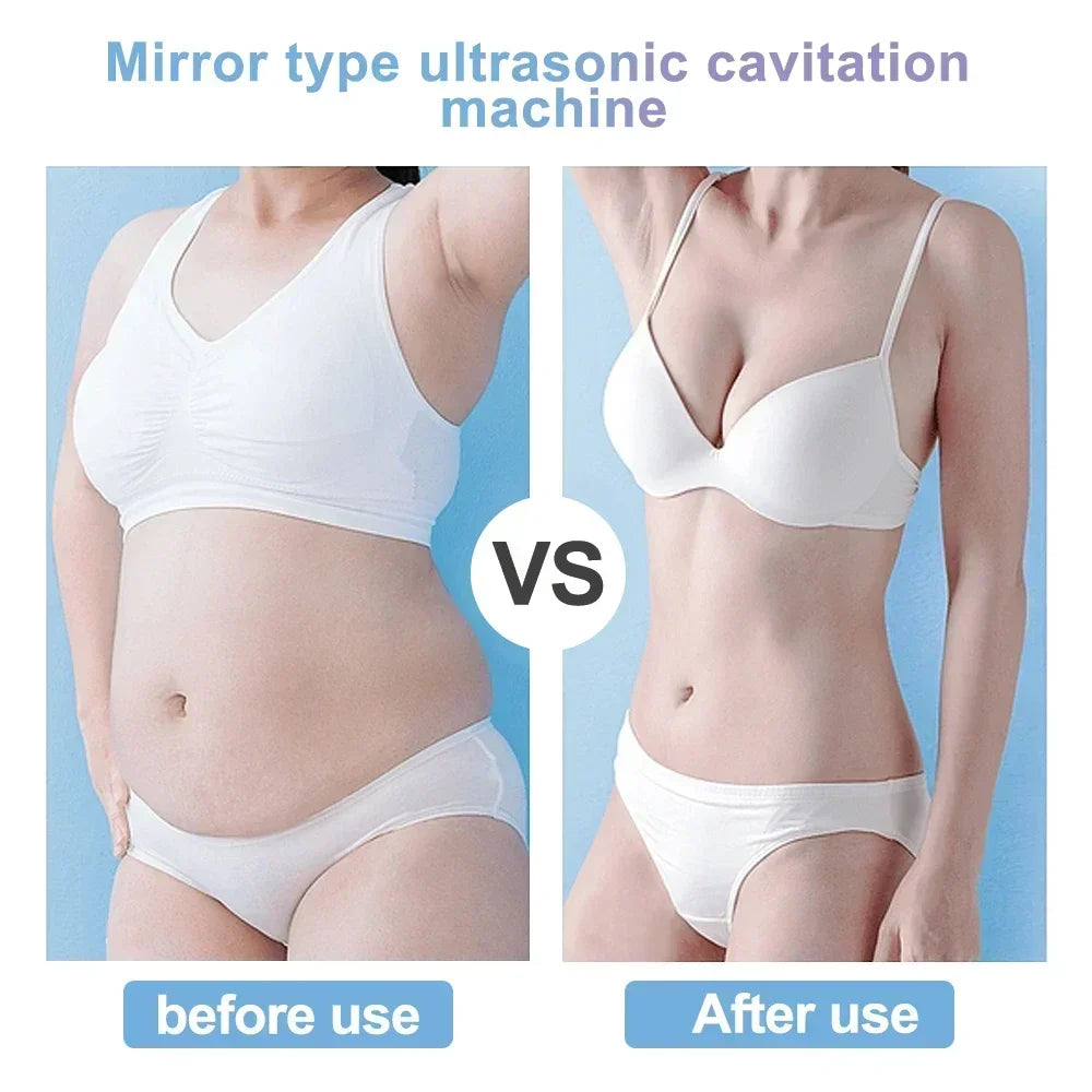 Beemyi 40K Ultrasonic Cavitation Machine for Body Slimming